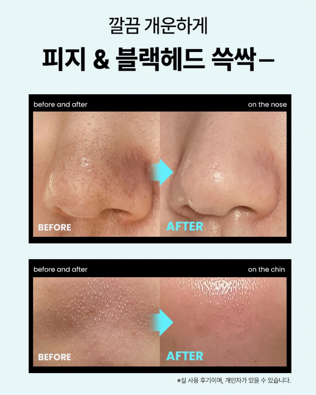 ILSO Super Melting Sebum Softener Set
