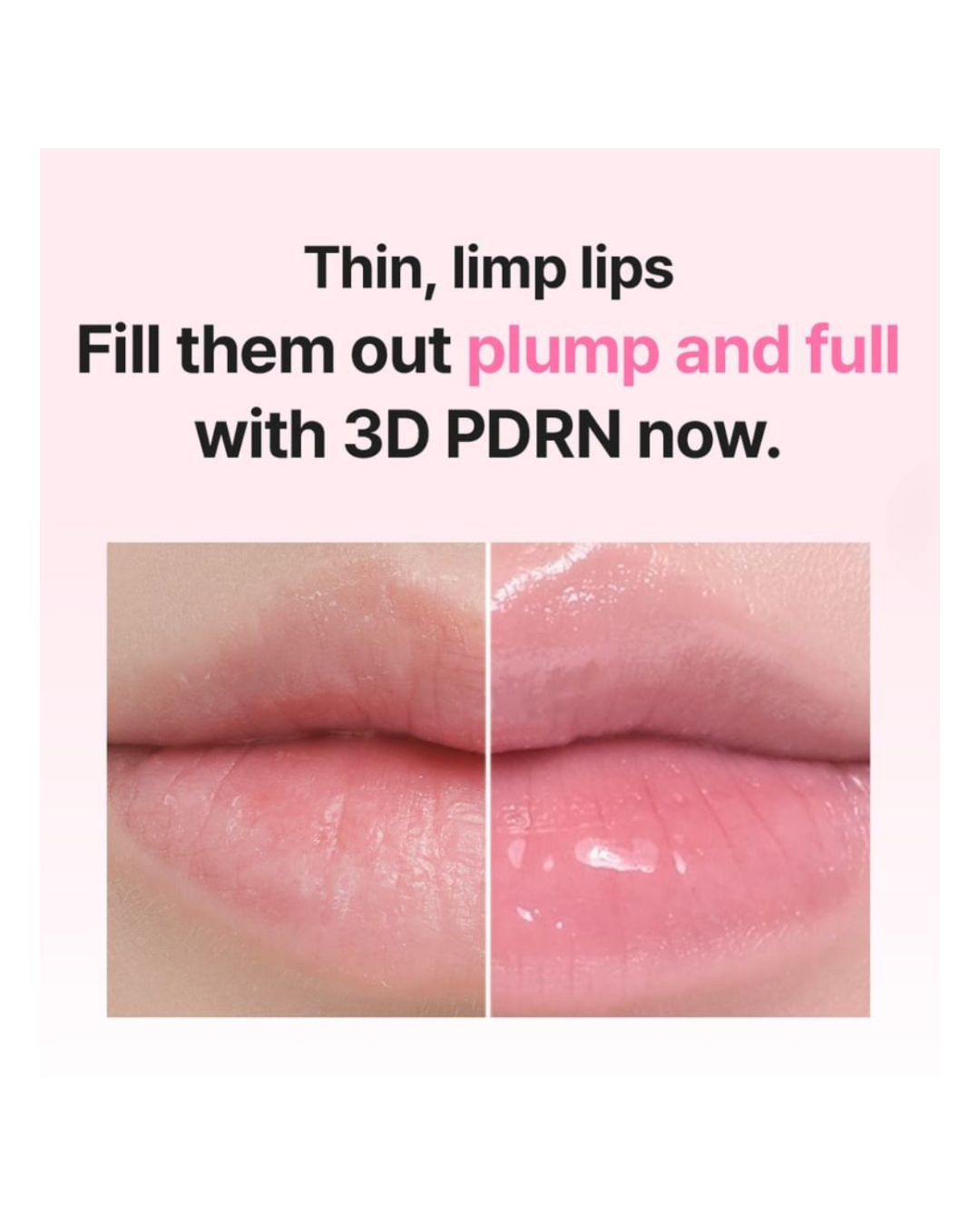SKIN&LAB 3D PDRN X Collagen Lip Serum Set